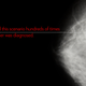 Illustration for article titled My BRCA Saga